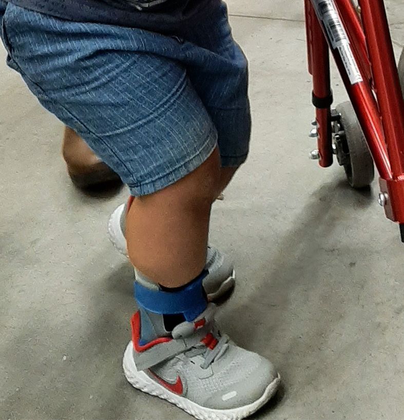 Foto detalle de una pierna de un niño con KIF1A en su andador