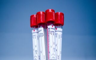 Muestras de sangre para análisis genético.