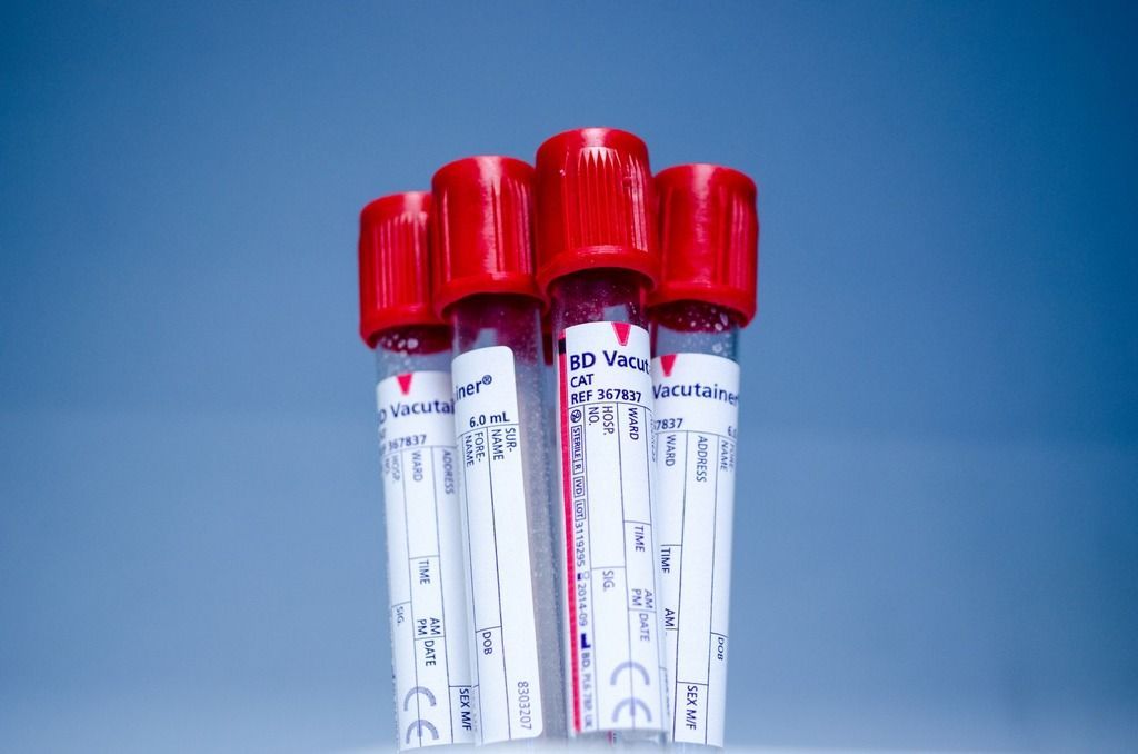 Muestras de sangre para análisis genético.